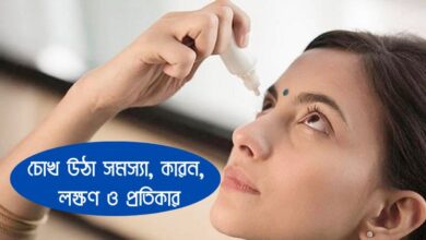 Photo of চোখ উঠা সমস্যা, কারন, লক্ষণ ও এর প্রতিকার